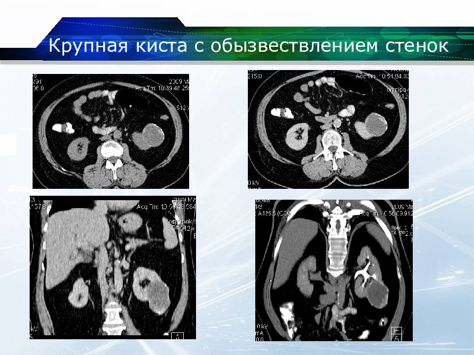 Кт почек презентация