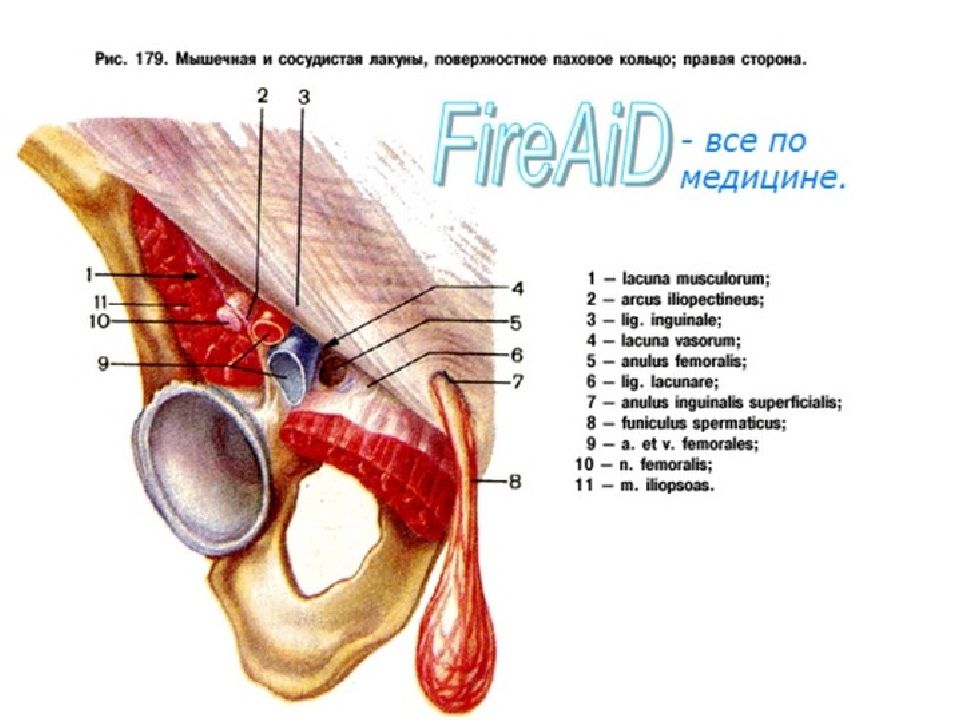 Сосудистая лакуна. Сосудистая и мышечная лакуны топография. Мышечная и сосудистая лакуны бедра. Сосудистая лакуна топография. Сосудистая лакуна на бедре.