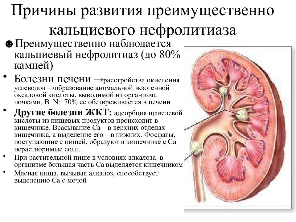 Каликоэктазия почек у детей