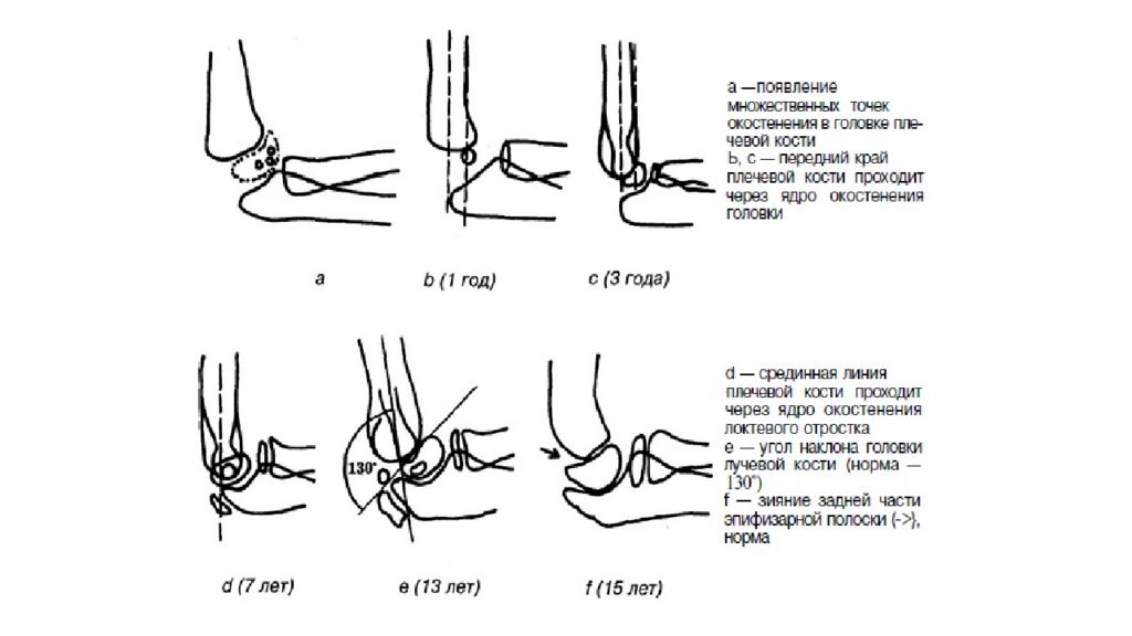 Точка появления. Окостенение локтевого отростка. Плечевая кость точки окостенения. Ядро окостенения локтевого отростка. Сроки окостенения локтевого отростка.
