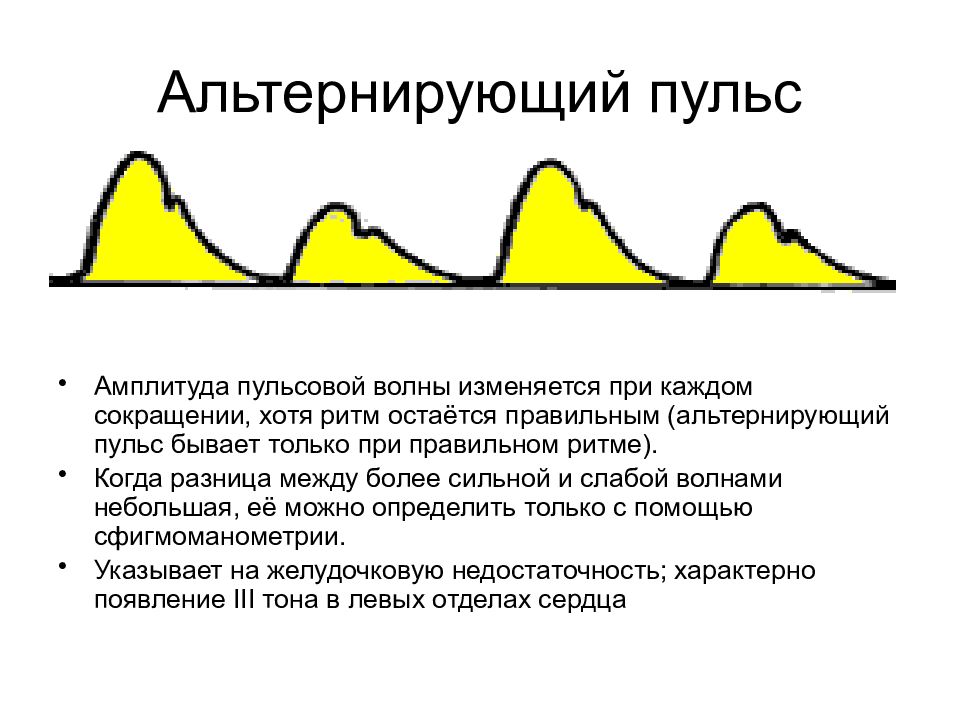 Малая амплитуда. Альтернирующий пульс. Причины и механизмы развития перемежающегося пульса. Альтернирующий пульс характеризуется:. Парадоксальный и альтернирующий пульс.