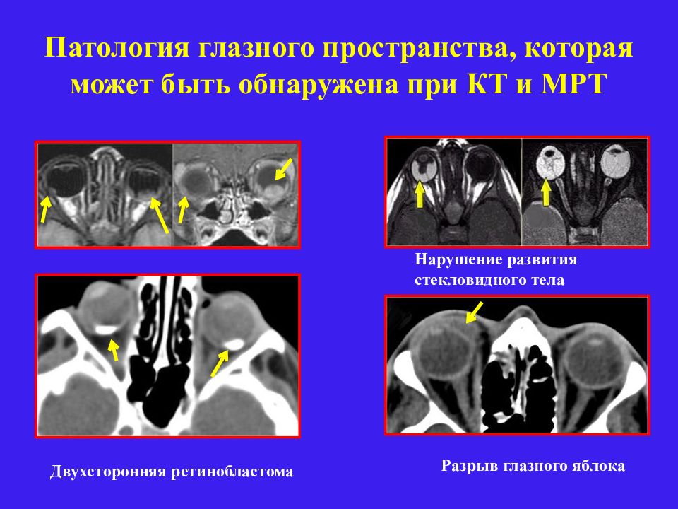 Лучевая диагностика заболеваний головы и шеи презентация