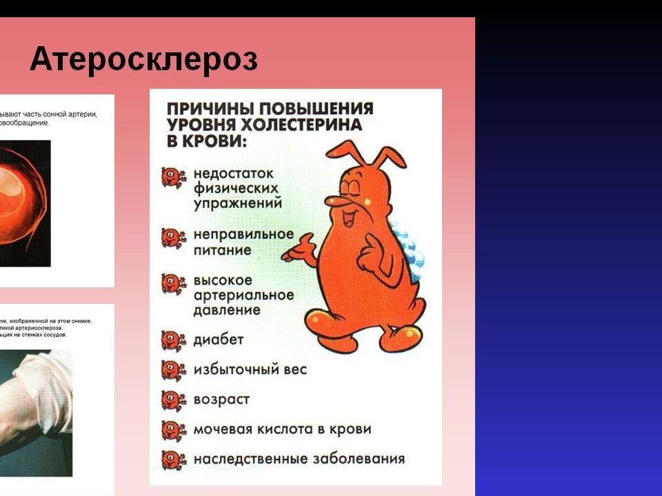 Осложнения атеросклероза тест. Осложнения атеросклероза. Нарушение функций сосудов.