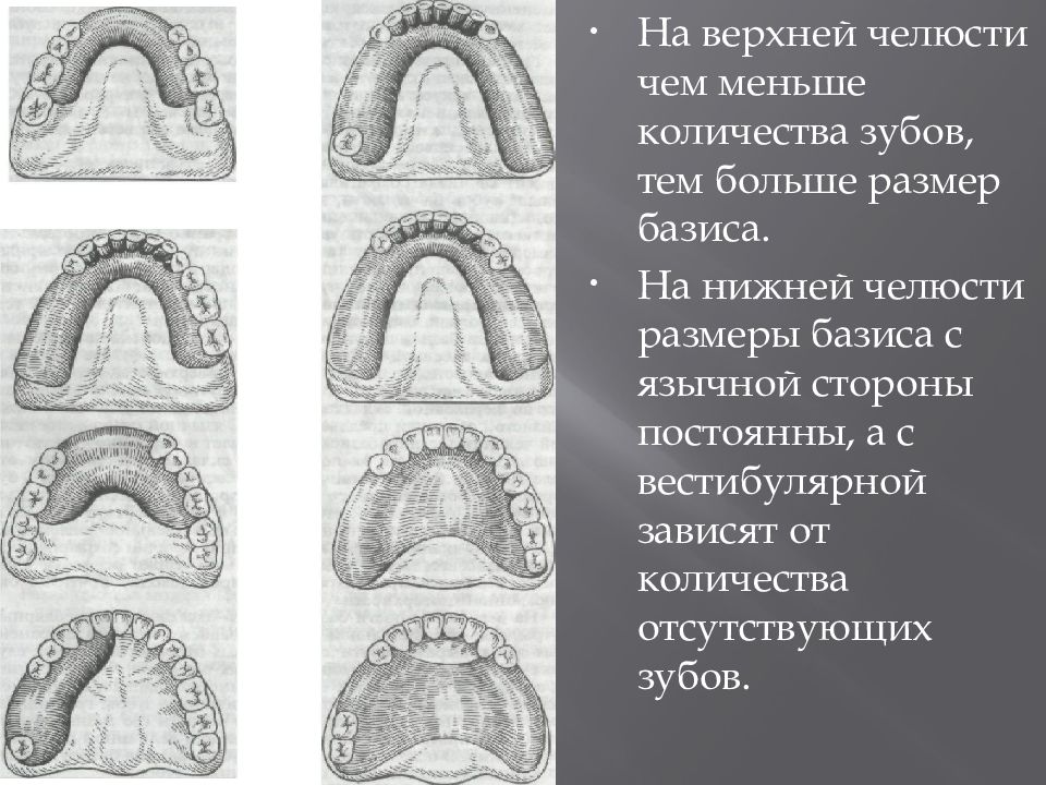 Резекция верхней челюсти презентация