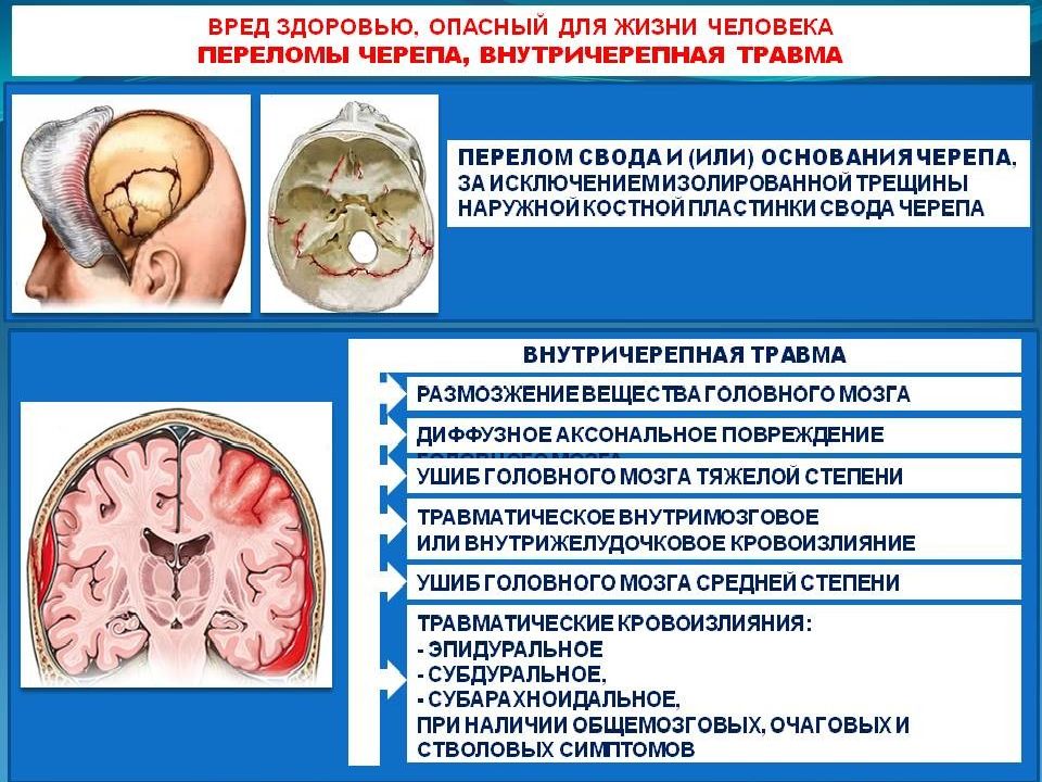 Жертвы ущерб здоровью людей. Вред опасный для жизни это. Сотрясение головного мозга судмед вред здоровью.