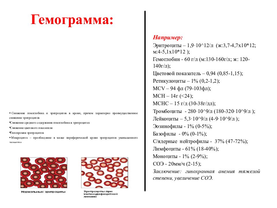 Гемограмма. Гемограмма анемии. Снижение эритроцитов и гемоглобина в крови. Железодефицитная анемия гемограмма.