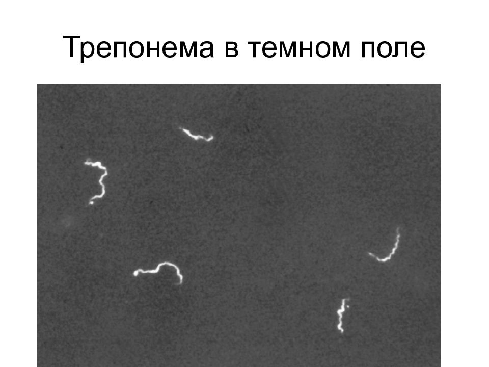 Трепонемы в темном поле зрения. Темнопольная микроскопия применяется для изучения. Темнопольная микроскопия бледной трепонемы. Исследование в темном поле. Темнопольный микроскоп схема.