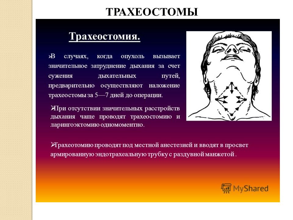 Трахеостома показания. Показания к трахеостомии. Показания к проведению трахеостомии. Сужение дыхательных путей. Трахеостомия показания к операции.