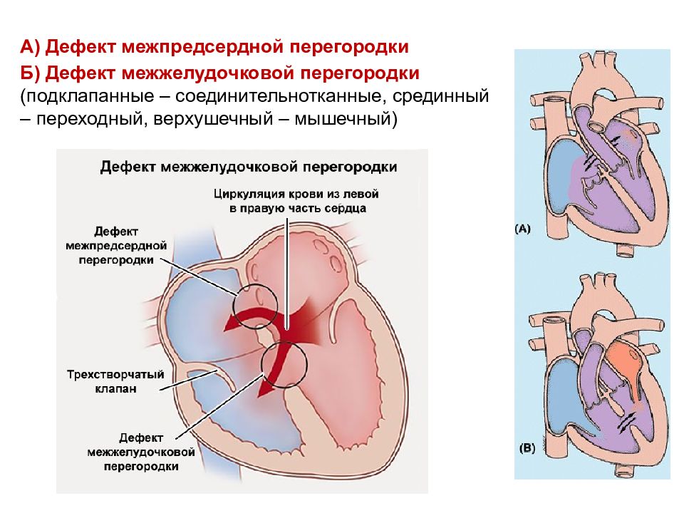 Дмпп у детей презентация