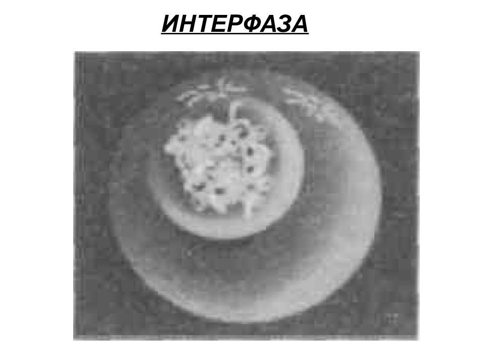 Интерфаза ядра. Интерфаза в микроскопе. Интерфаза под микроскопом. Интерфазные клетки. Строение ядра в интерфазе.