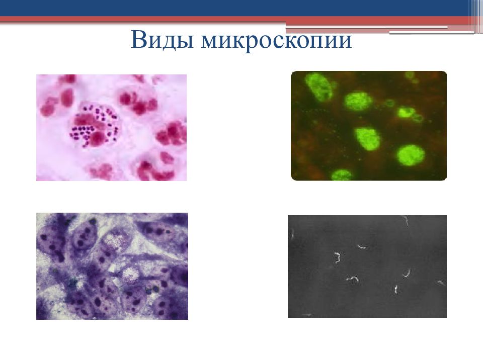 Виды микроскопии. Типы микроскопии. Типы микроскопирования. Разновидности микроскопии. Микроскопия виды микроскопии.