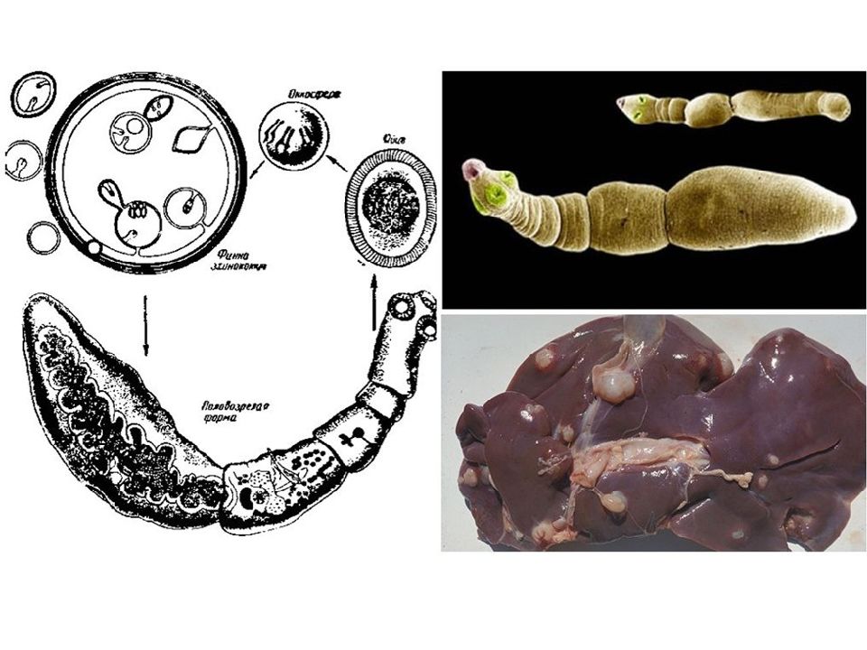 Эхинококкоз легких презентация