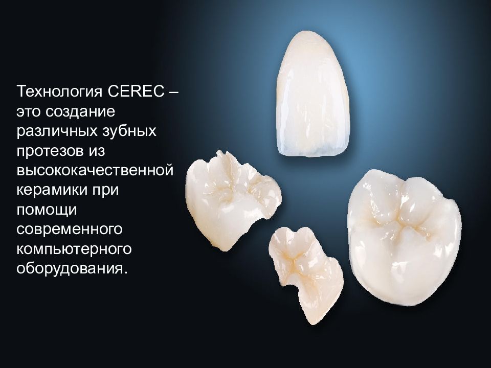 Современные компьютерные технологии ортопедического лечения дефектов коронок зубов презентация