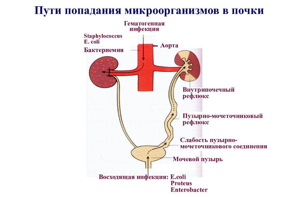 Презентация заболевания почек и мочевыводящих путей