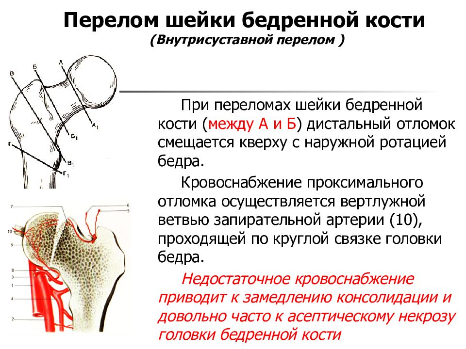 Перелом бедренной кости карта вызова