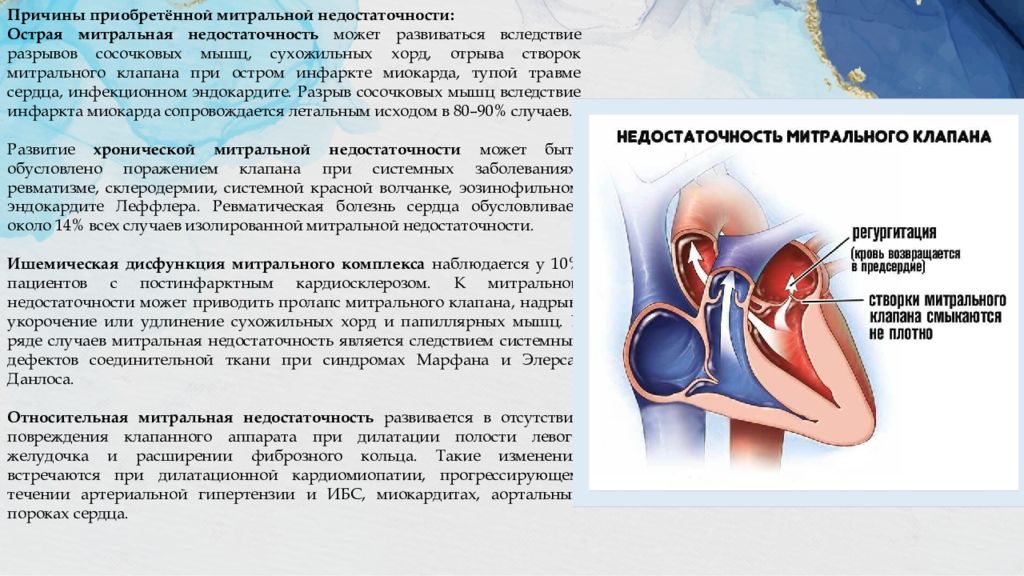 Чувствовать остановку сердца