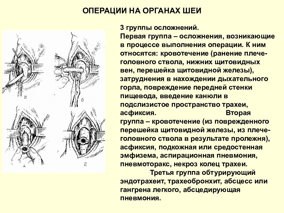 Операции на шее презентация