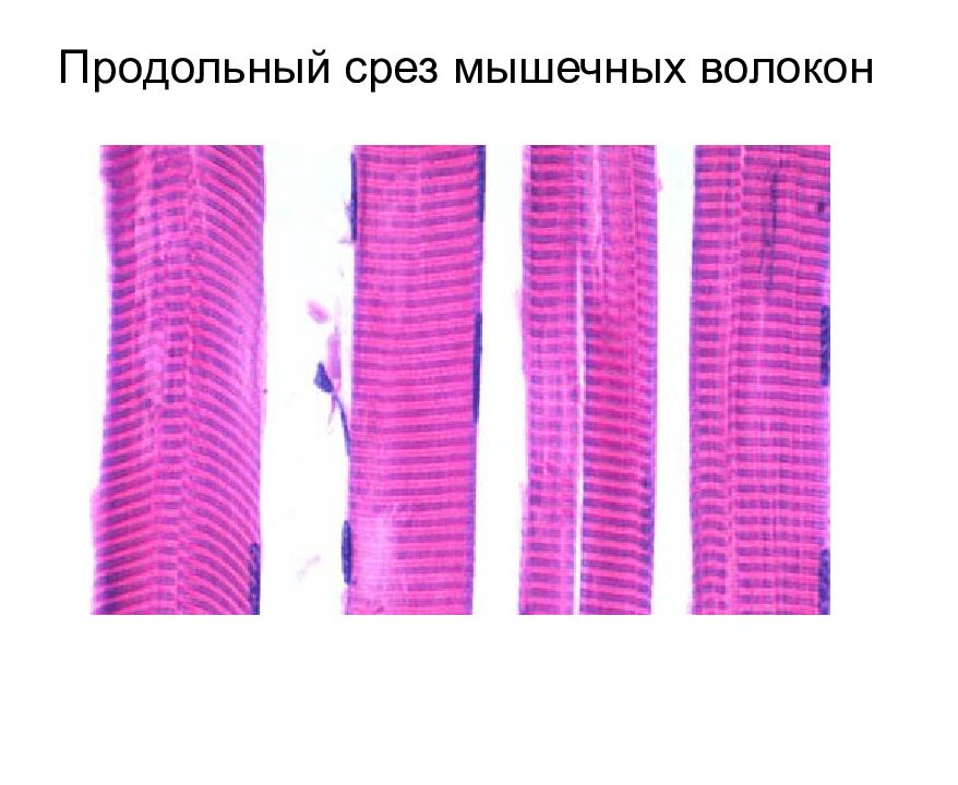 Строение мышечного волокна скелетной ткани. Красные и белые мышечные волокна физиология. Строение гладко мышечного волокна. Строение мышечного волокна егэ. Поперечнополосатая мышечная ткань языка препарат.