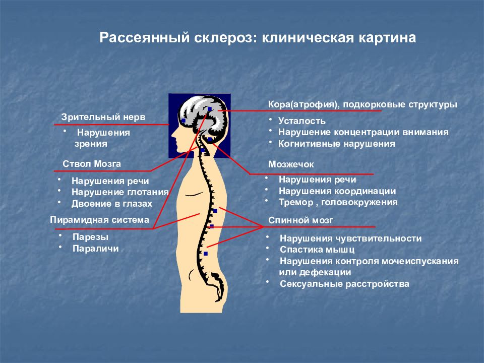 Рассеянный склероз презентация