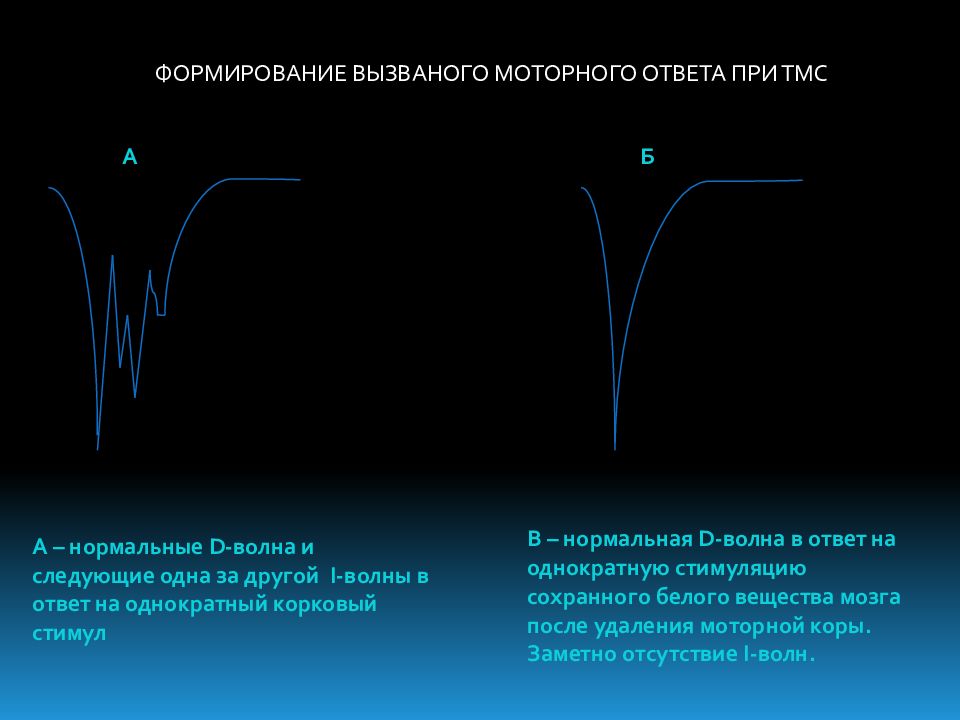 Нормальная волна. Транскраниальная магнитная стимуляция презентация. Транскраниальная магнитная стимуляция реакция. Вызванный моторный ответ. Метод ТМС В психологии.