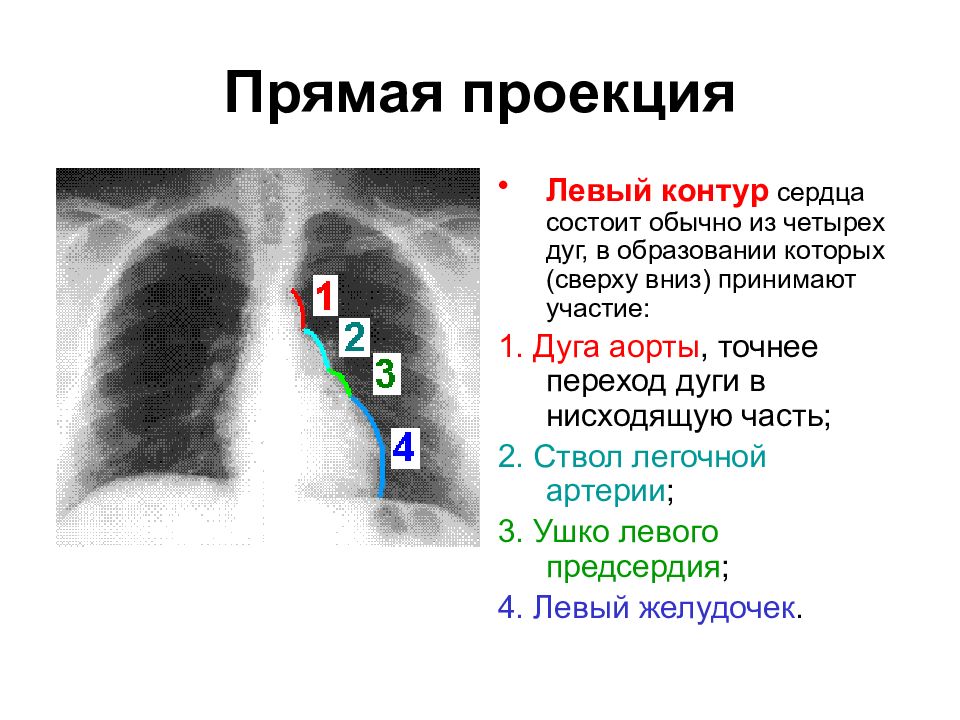 Прямая проекция рентгенограмма. Дуги сердца на рентгенограмме в прямой проекции. Дуги контура сердца на рентгенограмме. Дуги сердца на рентгене норма. Дуги тени сердца рентген.