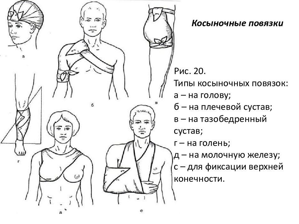 Основные виды повязок и правила их наложения презентация