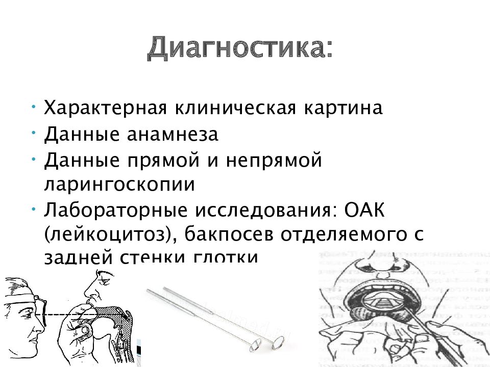 Ларингит симптомы и лечение у взрослых. Острый ларингит ларингоскопия. Непрямая ларингоскопия схема. Прямая и непрямая ларингоскопия.