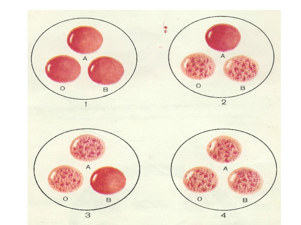 Группа крови агглютинация картинки