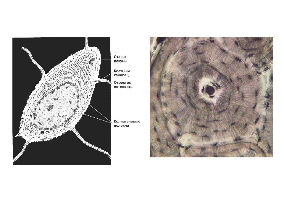 Клетка костной ткани остеоциты