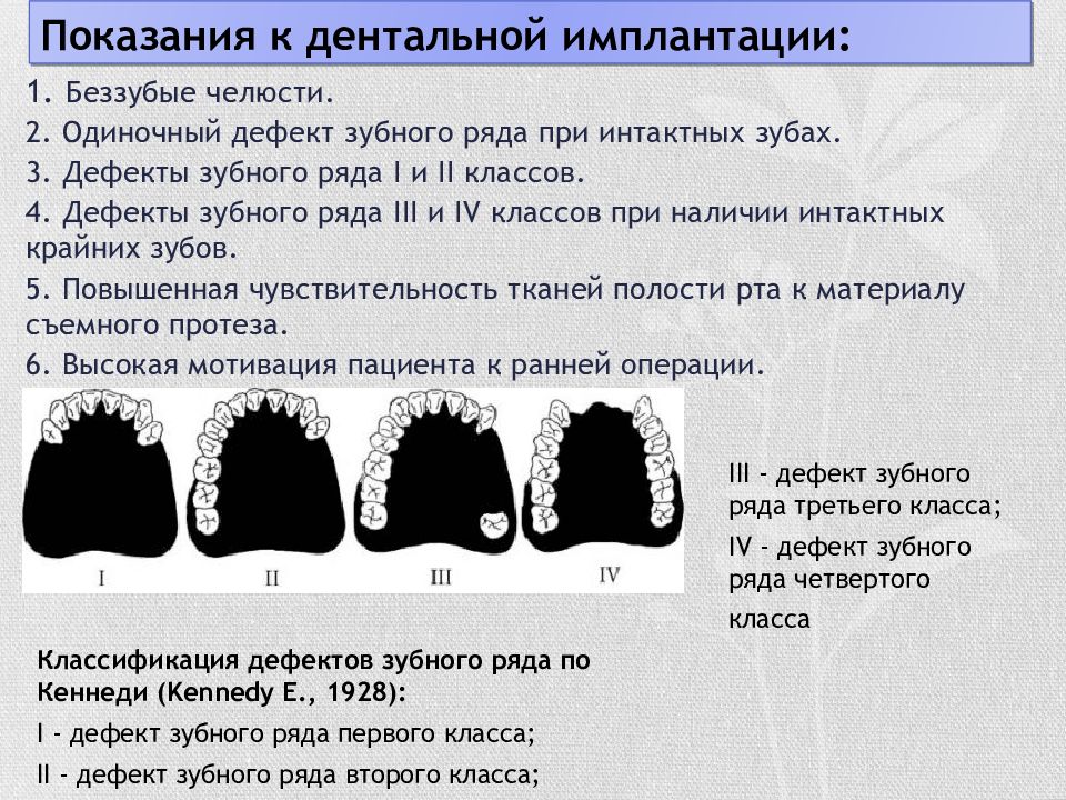 Дентальная имплантация презентация