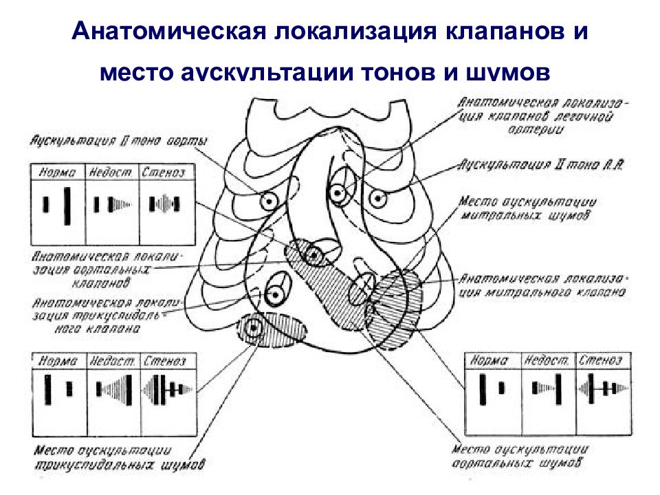 Шумы сердца пропедевтика презентация