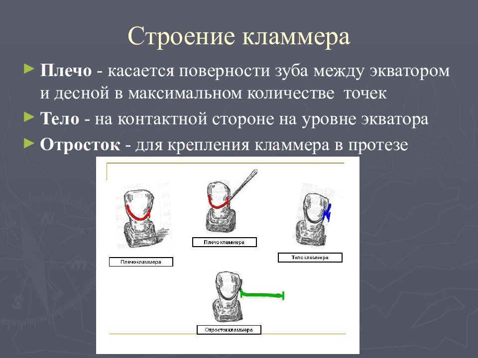 Составные элементы бюгельного протеза основные и дополнительные презентация