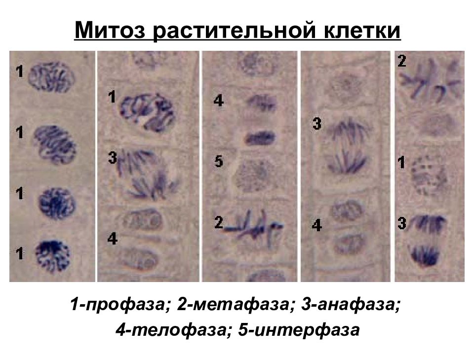 Единичные митозы. Фазы митоза в микроскопе. Фазы митоза на препарате.