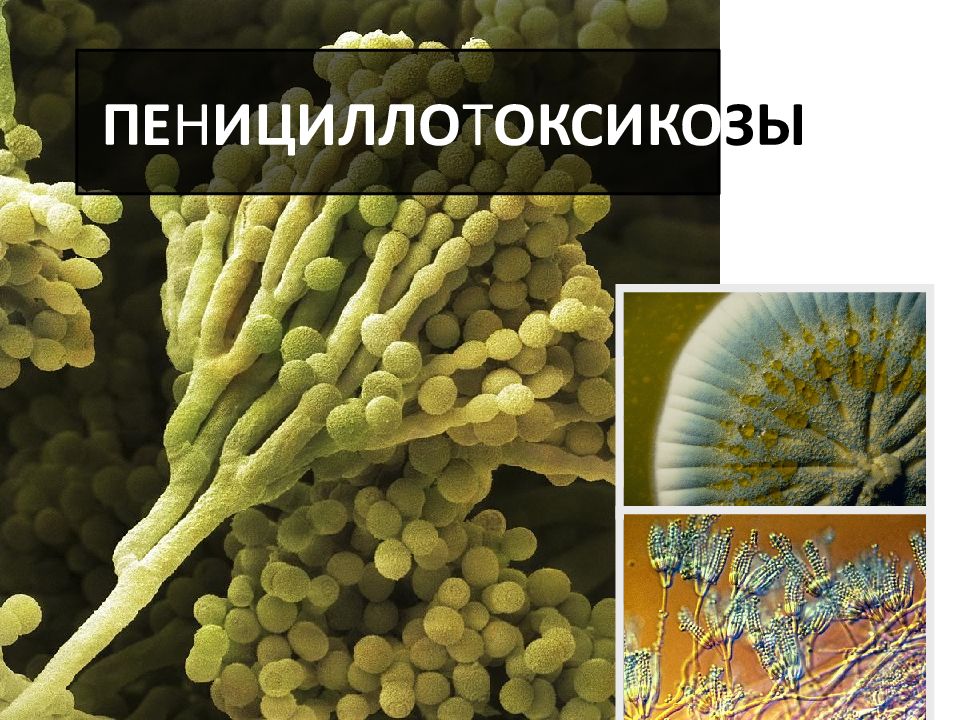 ПЕ Н ИЦИЛЛО Т ОКСИКО ЗЫ