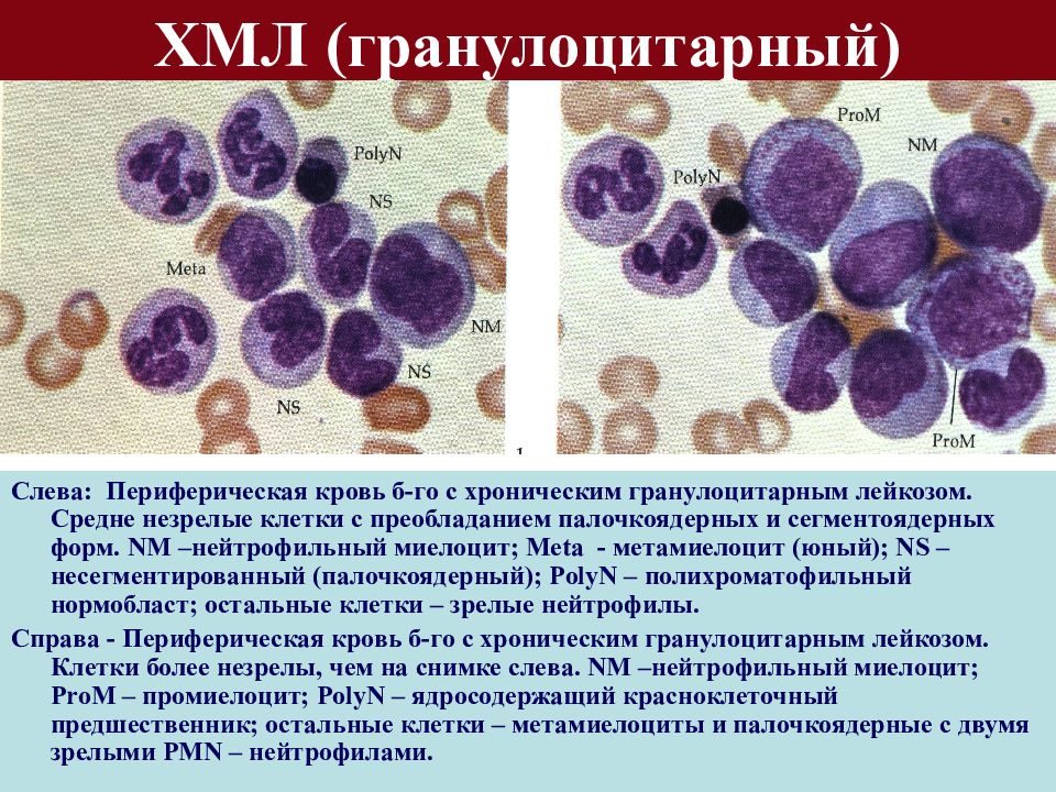 Нормобласты в крови картинки