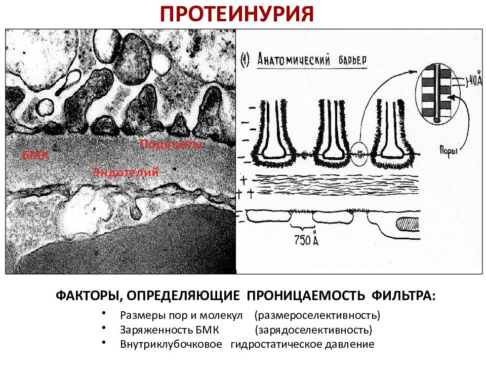 Базальная мембрана клубочка. Подоциты базальная мембрана. Базальная мембрана клубочка гистология. Строение базальной мембраны клубочка. Подоцит схема.