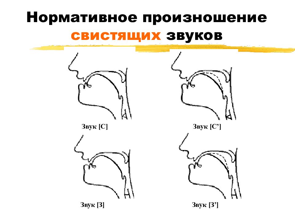 Положение языка в норме. Логопедические профили свистящих звуков при правильном произношении. Профили артикуляции свистящих звуков при ринолалии. Профили артикуляции свистящих звуков. С З. Нормативное произношение свистящих звуков.