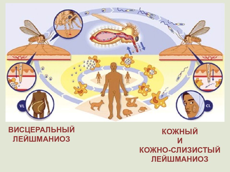 Висцеральный лейшманиоз диагностика. Висцеральный лейшманиоз. Профилактика кожного лейшманиоза. Профилактика висцерального лейшманиоза. Кожный и висцеральный лейшманиоз.