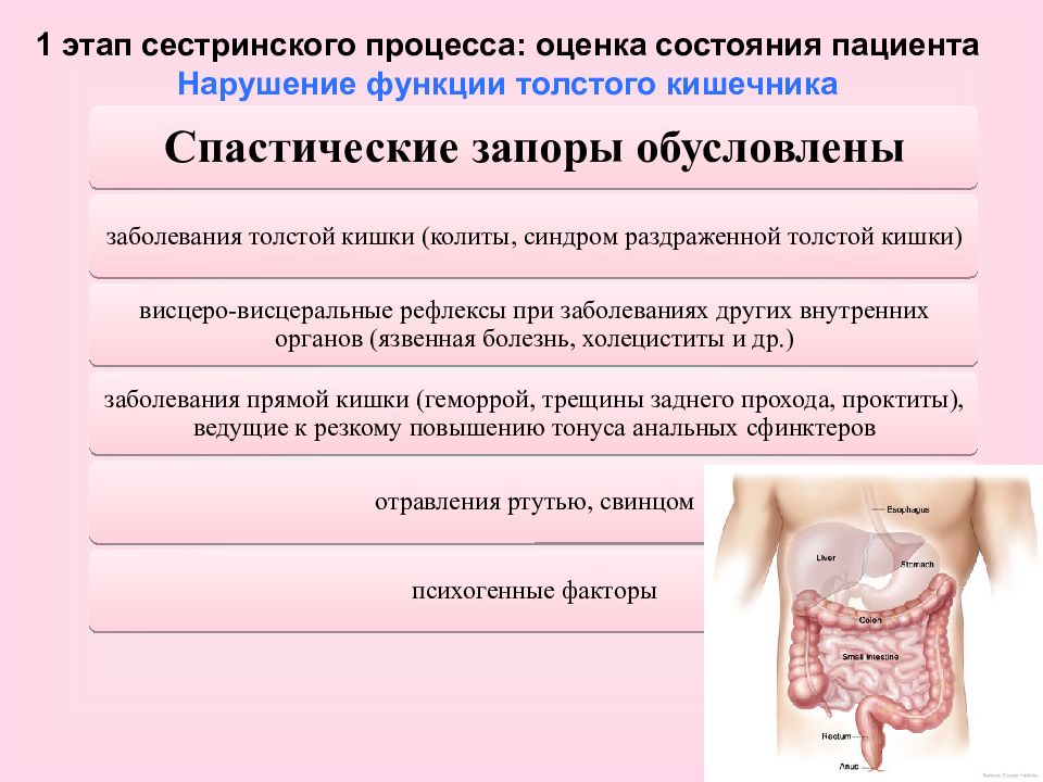 Сестринская карта геморрой