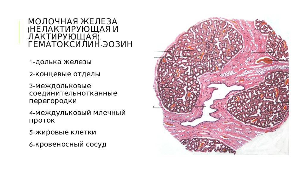 Гистология молочной. Нелактирующая молочная железа гистология препарат. Препарат лактирующей молочной железы гистология. Молочная железа гистология препарат. Лактирующая молочная железа гистология препарат с обозначениями.