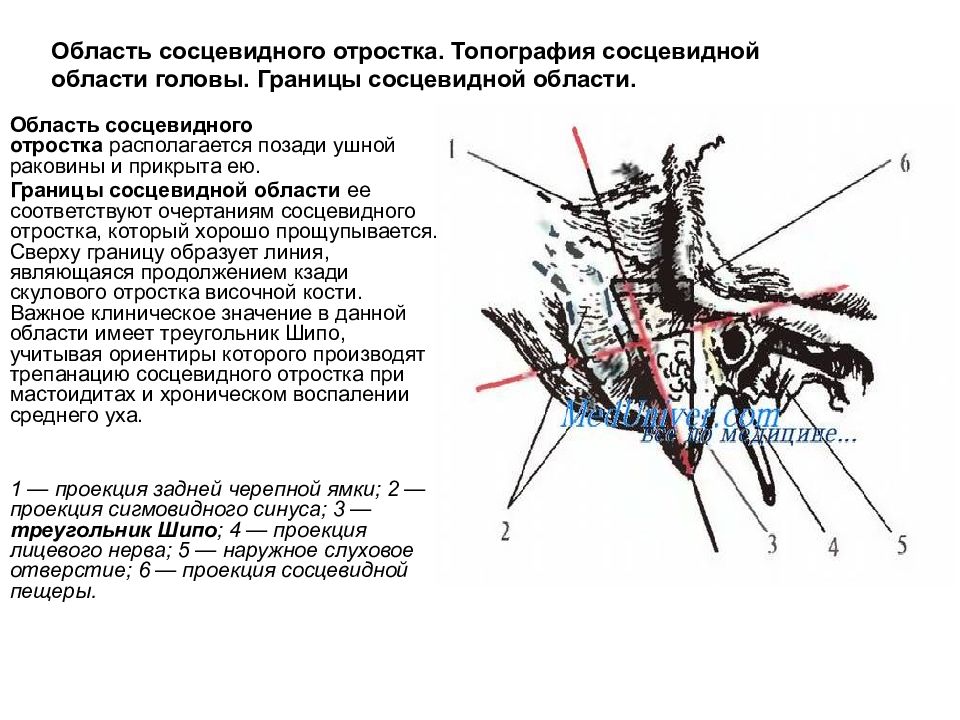 Трепанация треугольника шипо. Топография сосцевидного отростка. Область сосцевидного отростка топографическая анатомия. Топографическая анатомия сосцевидной области, треугольник шипо. Слои сосуды нервы области сосцевидного отростка.