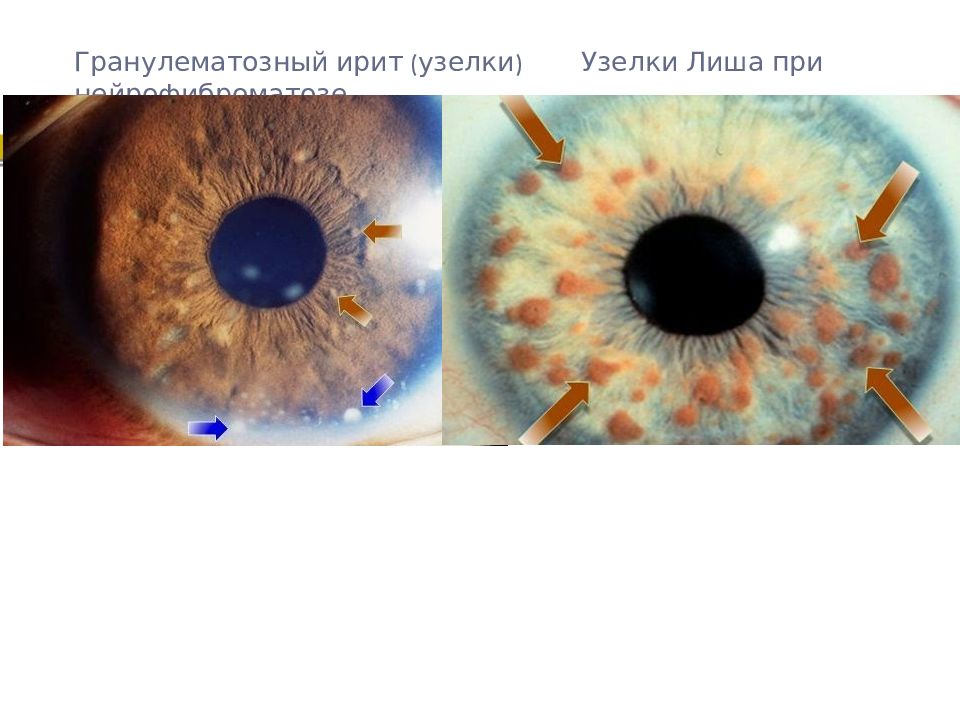 Ирит Это