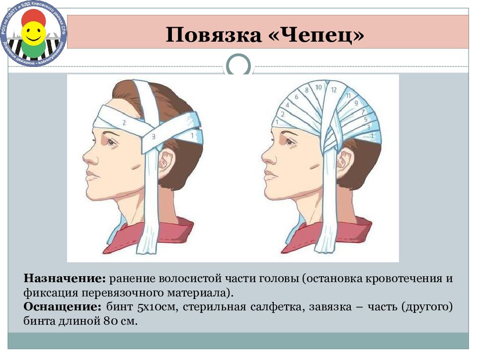 Техника наложения повязки чепец. Повязка чепец Назначение. Наложение повязки чепец. Повязка чепец алгоритм.