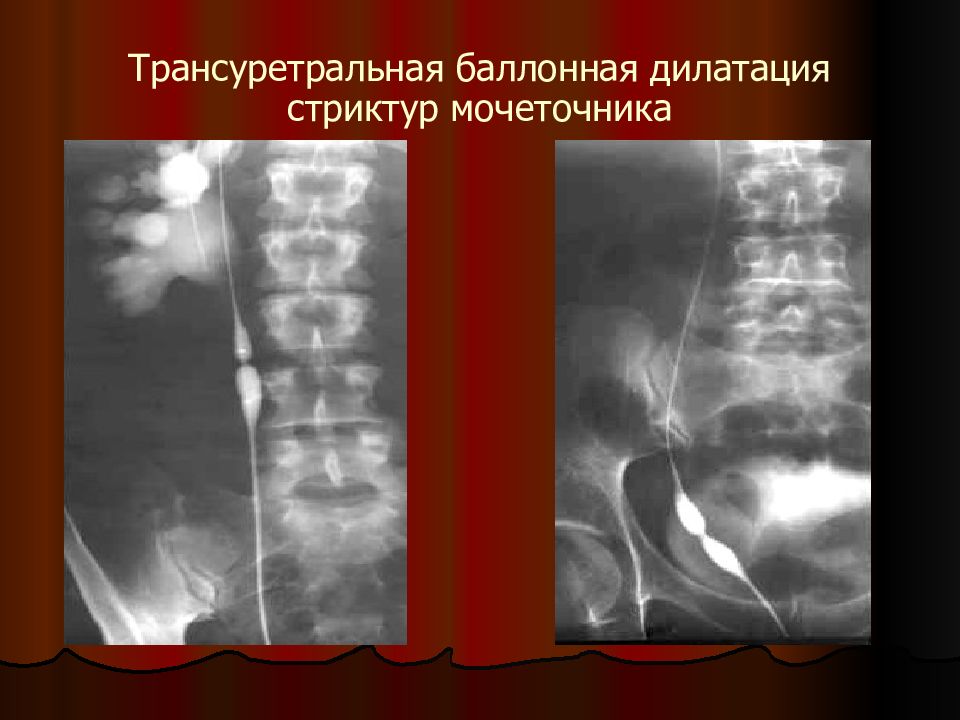 Интервенционная радиология презентация