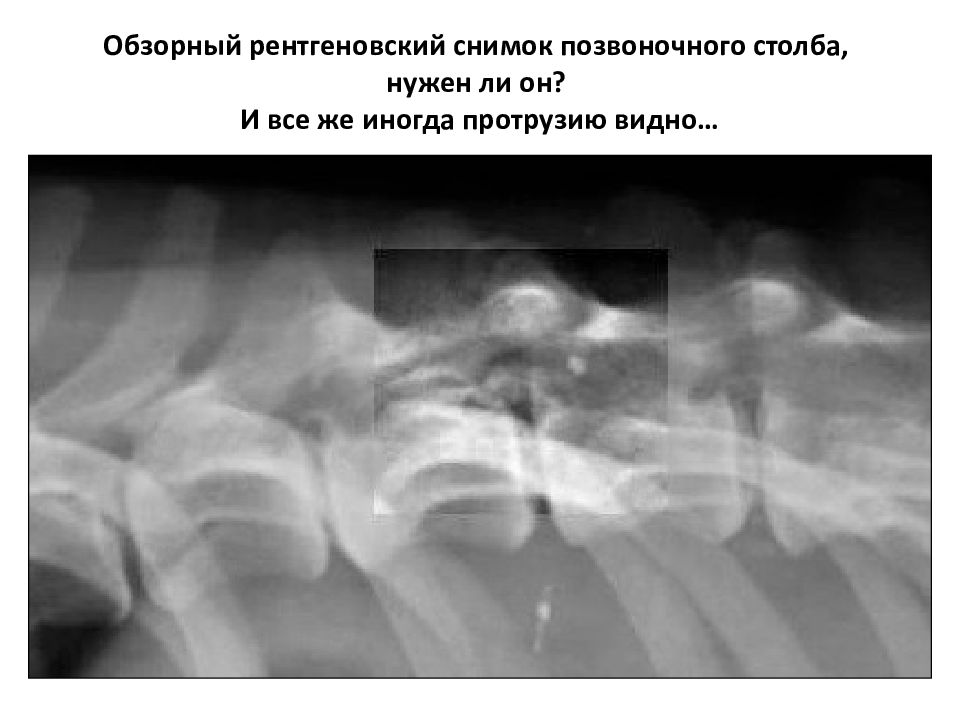 Как правильно рентген. Рентгеновский снимок. Обзорный рентгеновский снимок. Рентгенологический снимок обзорный. Обзорная и прицельная рентгенограмма.