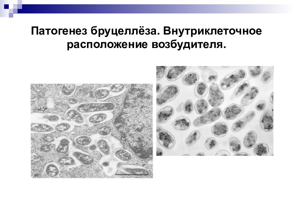 Бруцеллез патогенез схема