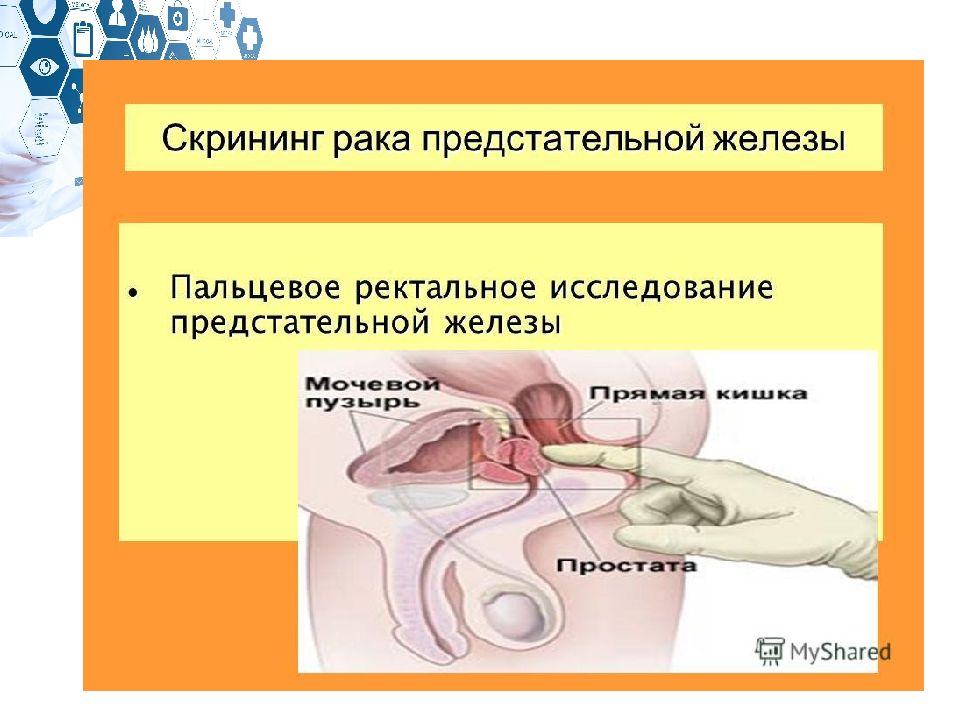 Предстательная железа исследование. Ректальное исследование предстательной железы. Пальцевое исследование предстательной железы. Скрининг предстательной железы. Пальцевое ректальное обследование простаты.