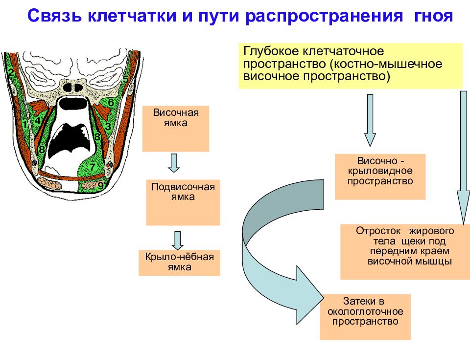 Пути распространения. Пути распространение гноя в височной области. Пути распространения гнойной инфекции клетчаточных пространств. Височно-крыловидное пространство пути распространения гноя. Пути распространения гноя в забрюшинном пространстве.