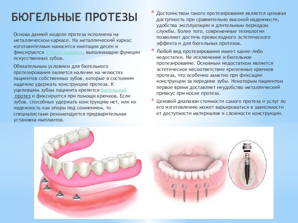 Съемные протезы презентация