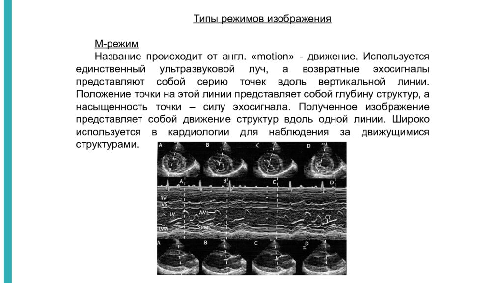 М режим. Методики ультразвукового исследования a-режим. B режим ультразвукового исследования. Типы режимов изображения УЗИ. А-режим ультразвукового исследования. УЗИ.